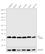 Histone H1.4 Antibody in Western Blot (WB)