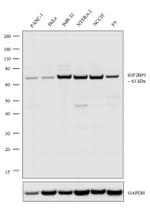 IGF2BP1 Antibody in Western Blot (WB)