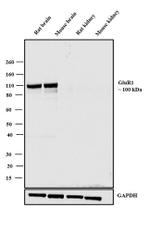 GluR1 Antibody in Western Blot (WB)