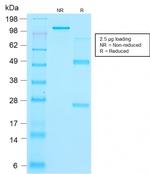 Thyroglobulin (Thyroidal Cell Marker) Antibody in SDS-PAGE (SDS-PAGE)