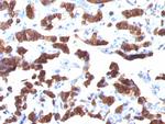 Thyroglobulin (Thyroidal Cell Marker) Antibody in Immunohistochemistry (Paraffin) (IHC (P))