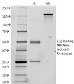 Thyroglobulin (Thyroidal Cell Marker) Antibody in SDS-PAGE (SDS-PAGE)