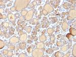 Thyroglobulin (Thyroidal Cell Marker) Antibody in Immunohistochemistry (Paraffin) (IHC (P))