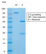 Thyroglobulin Antibody in SDS-PAGE (SDS-PAGE)