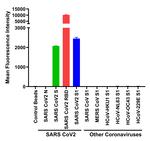 SARS-CoV-2 Spike Protein (RBD) Chimeric Antibody