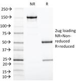 TIA1 (T-Cell-Restricted Intracellular Antigen-1) Antibody in SDS-PAGE (SDS-PAGE)