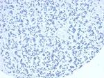 TIA1 (T-Cell-Restricted Intracellular Antigen-1) Antibody in Immunohistochemistry (Paraffin) (IHC (P))