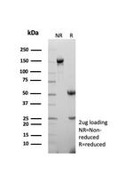 TTF-1/NKX2.1 (Thyroid and Lung Epithelial Marker) Antibody in SDS-PAGE (SDS-PAGE)