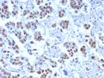 TLE1 (Synovial Sarcoma Marker) Antibody in Immunohistochemistry (Paraffin) (IHC (P))