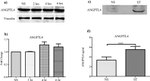 ANGPTL4 Antibody in Western Blot (WB)