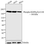 Phospho-EGFR (Tyr1148) Antibody in Western Blot (WB)