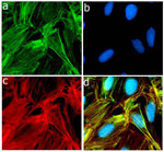 P-Selectin Antibody in Immunocytochemistry (ICC/IF)