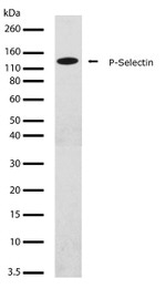 P-Selectin Antibody in Western Blot (WB)