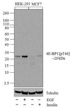 Phospho-4EBP1 (Thr46) Antibody