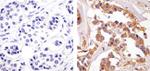 ErbB2 (HER-2) Antibody in Immunohistochemistry (Paraffin) (IHC (P))