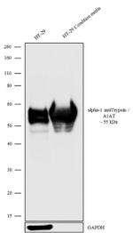 alpha-1 Antitrypsin Antibody in Western Blot (WB)