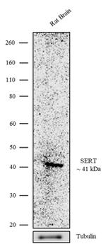 SLC6A4 Antibody in Western Blot (WB)