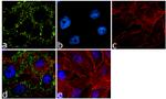 Desmoplakin Antibody in Immunocytochemistry (ICC/IF)