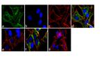 Phospho-CaMKII (Thr305,Thr306) Antibody in Immunocytochemistry (ICC/IF)