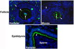 ZO-2 Antibody in Immunohistochemistry (IHC)