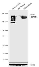 MYH11 Recombinant Polyclonal Antibody