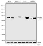 HRI Antibody in Western Blot (WB)