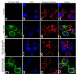 Phospho-PKC beta-1 (Thr642) Antibody in Immunocytochemistry (ICC/IF)