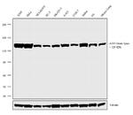 ATP Citrate lyase Antibody in Western Blot (WB)