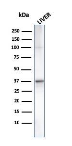 C1QA/Complement C1q A-Chain Antibody in Western Blot (WB)