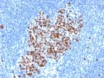 Topoisomerase II alpha Antibody in Immunohistochemistry (Paraffin) (IHC (P))