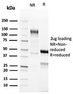 Topoisomerase II alpha (Proliferation and Drug-Resistance Marker) Antibody in SDS-PAGE (SDS-PAGE)