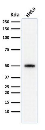 p53 Tumor Suppressor Protein Antibody in Western Blot (WB)