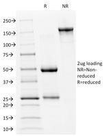p53 Tumor Suppressor Protein Antibody in SDS-PAGE (SDS-PAGE)