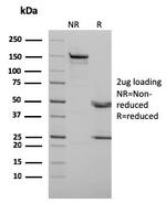 p73 (Tumor Suppressor) Antibody in SDS-PAGE (SDS-PAGE)