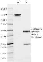 Tryptase (Mast Cell Marker) Antibody in SDS-PAGE (SDS-PAGE)