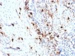 Tryptase (Mast Cell Marker) Antibody in Immunohistochemistry (Paraffin) (IHC (P))