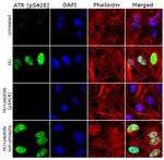 Phospho-ATR (Ser428) Antibody in Immunocytochemistry (ICC/IF)