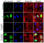 Phospho-ATR (Ser428) Antibody