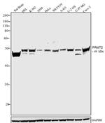 PRMT2 Antibody in Western Blot (WB)