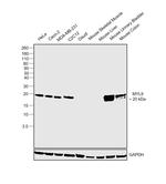 MYL9 Antibody in Western Blot (WB)