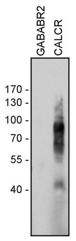 Calcitonin Receptor Antibody in Western Blot (WB)