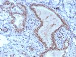 TRPS1 (Transcriptional repressor GATA binding 1) Antibody in Immunohistochemistry (Paraffin) (IHC (P))