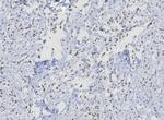 TRPS1 (Transcriptional repressor GATA binding 1) Antibody in Immunohistochemistry (Paraffin) (IHC (P))