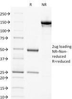 Thymidylate Synthase Antibody in SDS-PAGE (SDS-PAGE)