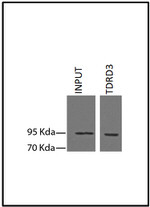 TDRD3 Antibody in Immunoprecipitation (IP)