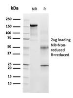 Tyrosinase-Related Protein-1 (TYRP-1) (Melanoma Marker) Antibody in SDS-PAGE (SDS-PAGE)