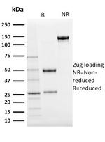 Ubiquitin (Autophagy Marker) Antibody in SDS-PAGE (SDS-PAGE)