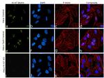 Ki-67 Antibody