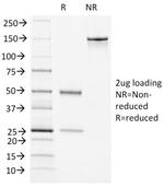 von Willebrand Factor/Factor VIII Related-Ag Antibody in SDS-PAGE (SDS-PAGE)
