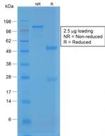 von Willebrand Factor/Factor VIII Related-Ag Antibody in SDS-PAGE (SDS-PAGE)